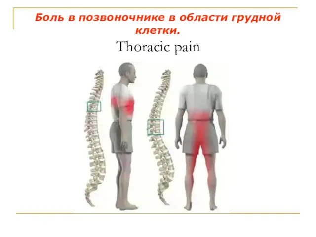 Боль в позвоночнике в области грудной клетки. Thoracic pain