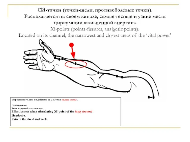 СИ-точки (точки-щели, противоболевые точки). Располагается на своем канале, самые тесные и узкие