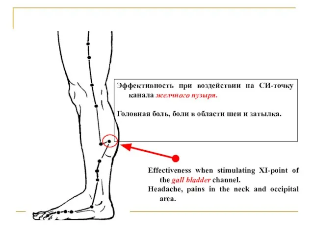 Effectiveness when stimulating XI-point of the gall bladder channel. Headache, pains in