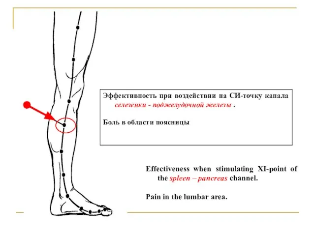 Effectiveness when stimulating XI-point of the spleen – pancreas channel. Pain in the lumbar area.