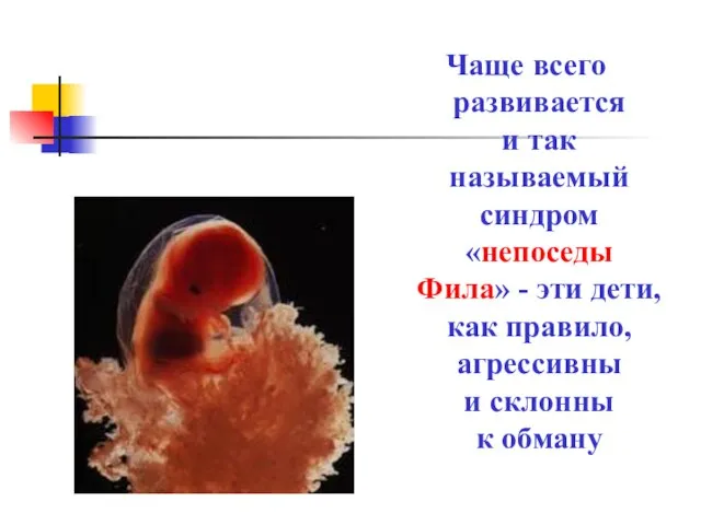 Чаще всего развивается и так называемый синдром «непоседы Фила» - эти дети,