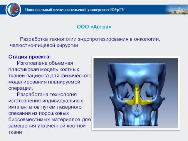 ООО «Астра» Разработка технологии эндопротезирования в онкологии, челюстно-лицевой хирургии Стадия проекта: Изготовлена