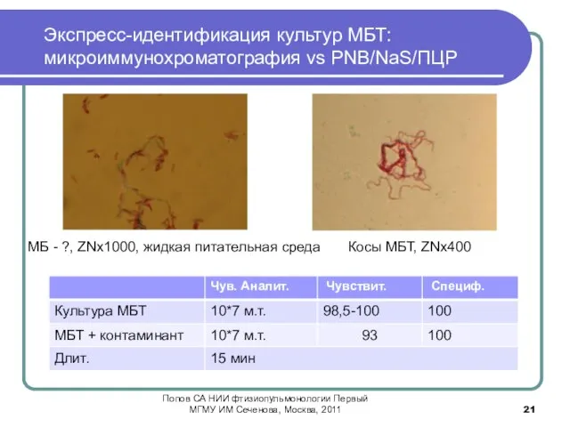 Экспресс-идентификация культур МБТ: микроиммунохроматография vs PNB/NaS/ПЦР Косы МБТ, ZNх400 МБ - ?,