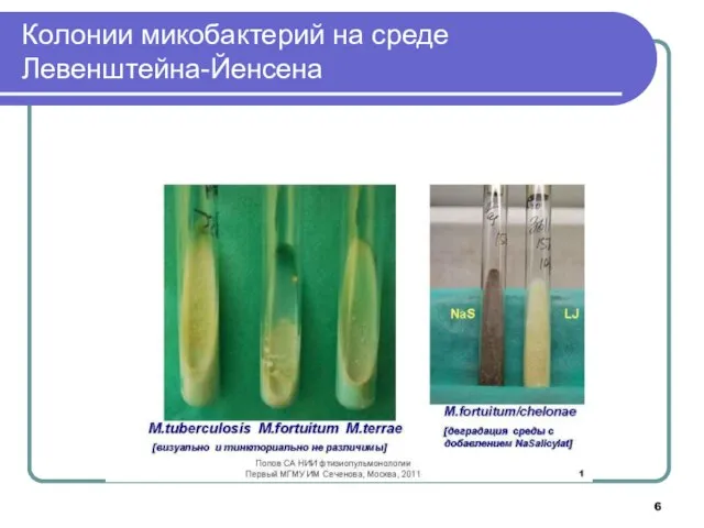 Колонии микобактерий на среде Левенштейна-Йенсена