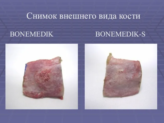 Снимок внешнего вида кости BONEMEDIK BONEMEDIK-S