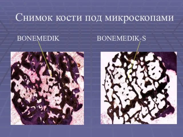 BONEMEDIK BONEMEDIK-S Снимок кости под микроскопами