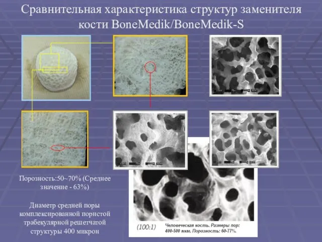 Сравнительная характеристика структур заменителя кости BoneMedik/BoneMedik-S Порозность:50~70% (Среднее значение - 63%) Диаметр