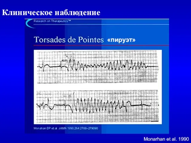 Клиническое наблюдение Monarhan et al. 1990 «пируэт»