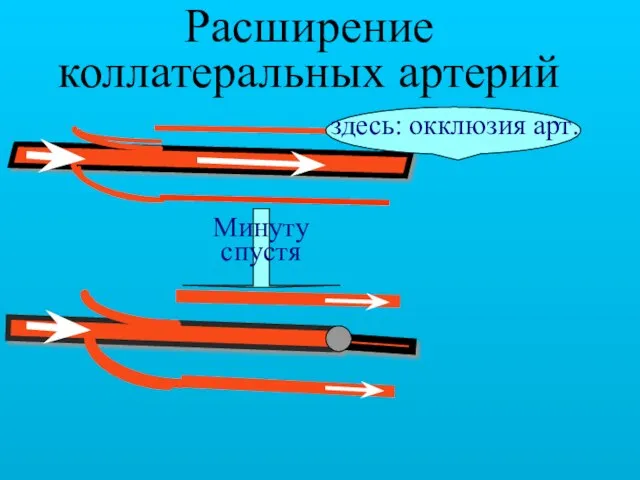 Расширение коллатеральных артерий здесь: окклюзия арт. Минуту спустя