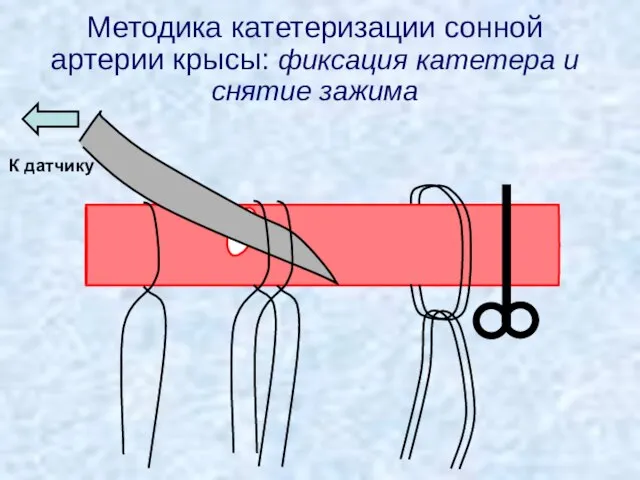 Методика катетеризации сонной артерии крысы: фиксация катетера и снятие зажима