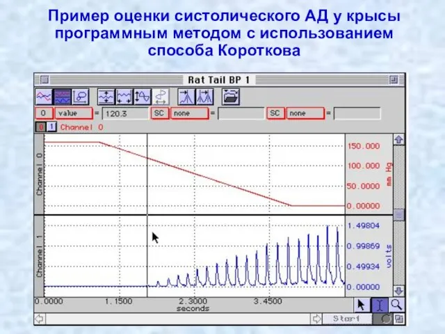 Пример оценки систолического АД у крысы программным методом с использованием способа Короткова