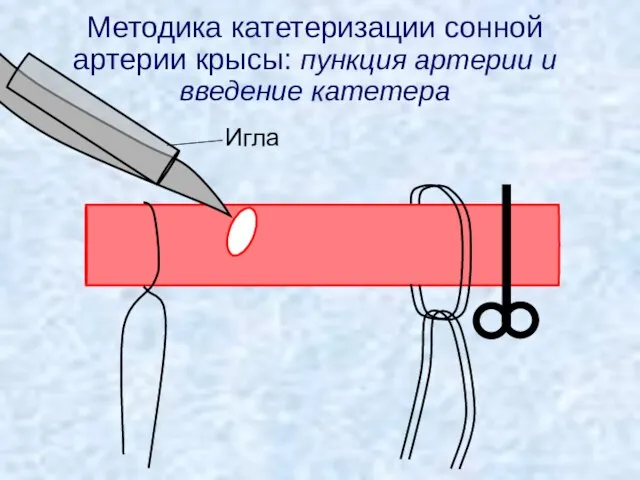 Методика катетеризации сонной артерии крысы: пункция артерии и введение катетера Игла