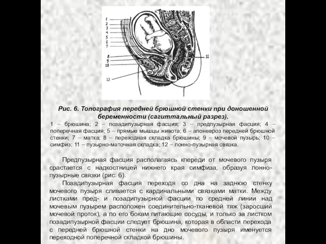 Рис. 6. Топография передней брюшной стенки при доношенной беременности (сагиттальный разрез). 1