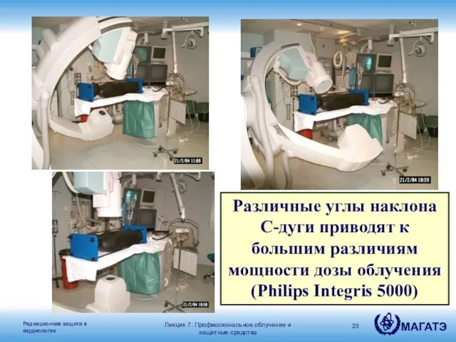 Различные углы наклона C-дуги приводят к большим различиям мощности дозы облучения (Philips