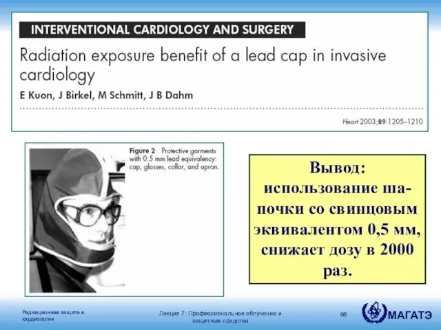 Вывод: использование ша-почки со свинцовым эквивалентом 0,5 мм, снижает дозу в 2000