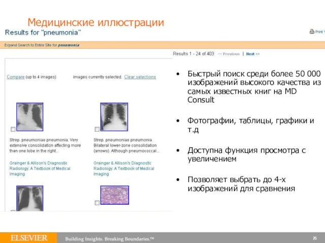 Медицинские иллюстрации Быстрый поиск среди более 50 000 изображений высокого качества из