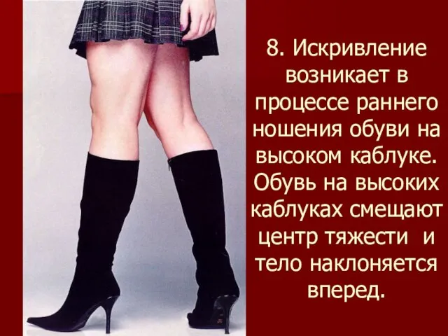 8. Искривление возникает в процессе раннего ношения обуви на высоком каблуке. Обувь