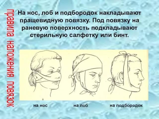 На нос, лоб и подбородок накладывают пращевидную повязку. Под повязку на раневую