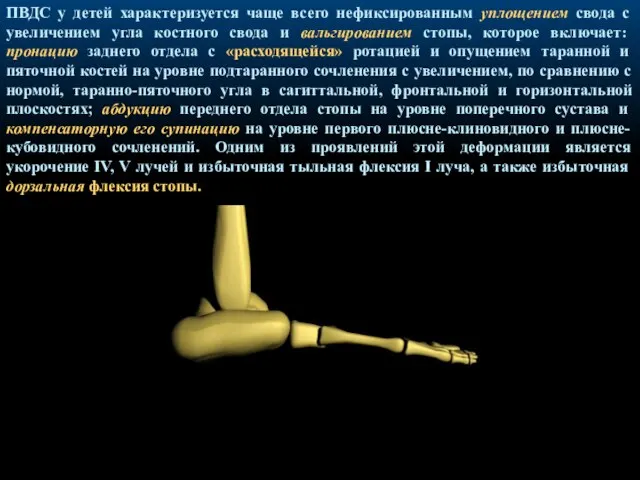 ПВДС у детей характеризуется чаще всего нефиксированным уплощением свода с увеличением угла