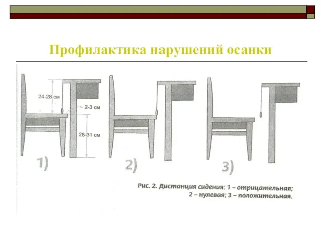 Профилактика нарушений осанки