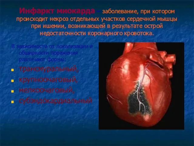Инфаркт миокарда – заболевание, при котором происходит некроз отдельных участков сердечной мышцы