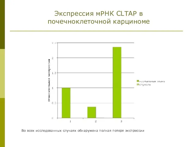 Экспрессия мРНК CLTAP в почечноклеточной карциноме Во всех исследованных случаях обнаружена полная потеря экспрессии