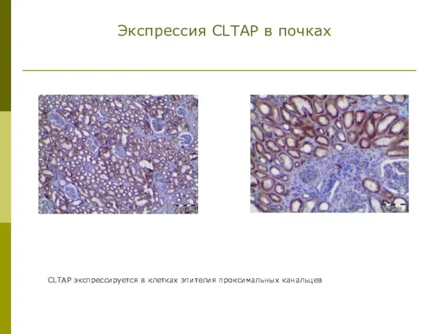 Экспрессия CLTAP в почках CLTAP экспрессируется в клетках эпителия проксимальных канальцев