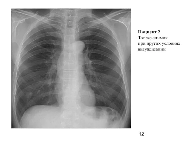 Пациент 2 Тот же снимок при других условиях визуализации
