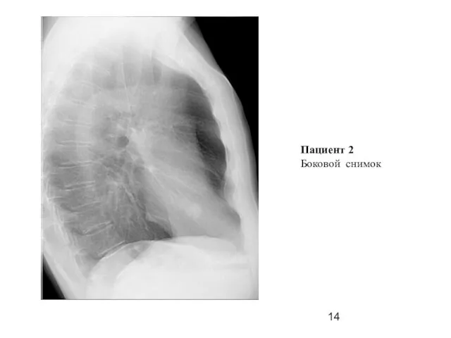 Пациент 2 Боковой снимок