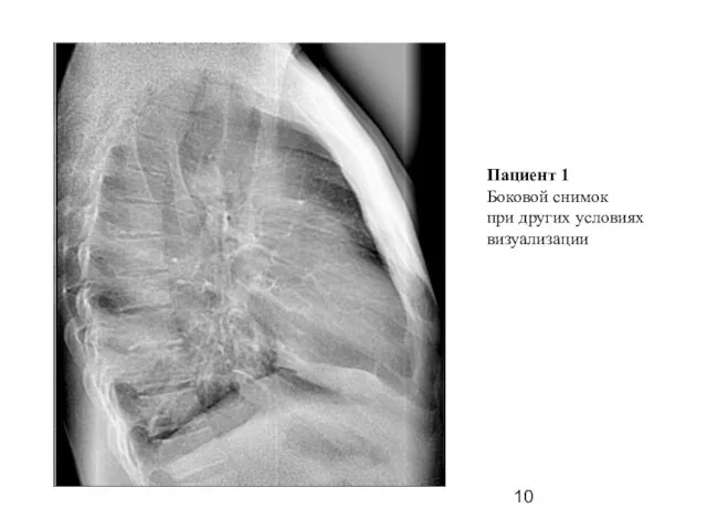 Пациент 1 Боковой снимок при других условиях визуализации