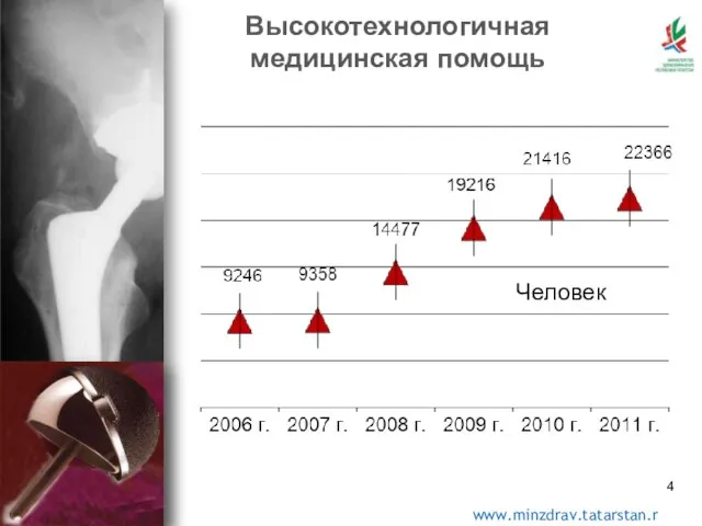 *прогноз Высокотехнологичная медицинская помощь Человек