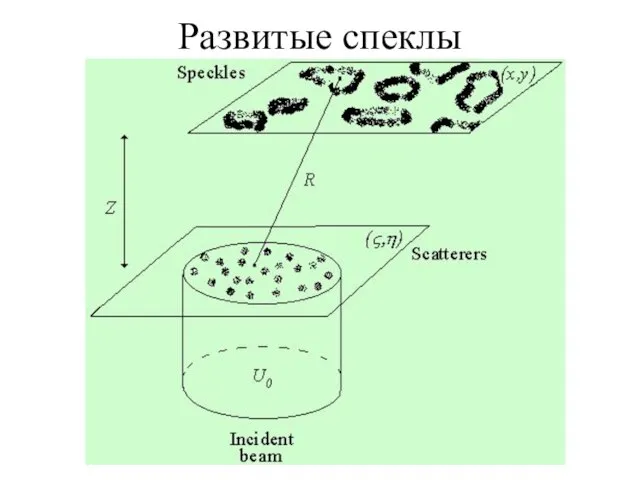 Развитые спеклы