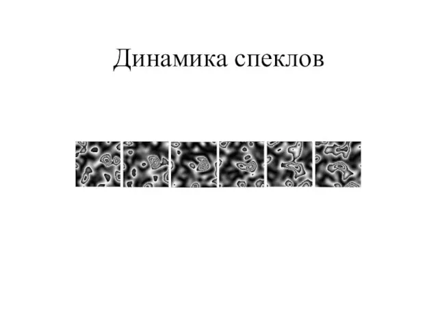 Динамика спеклов