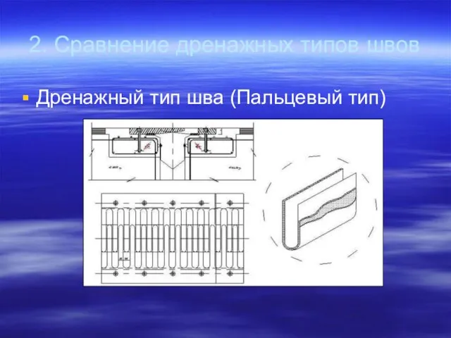 2. Сравнение дренажных типов швов Дренажный тип шва (Пальцевый тип)