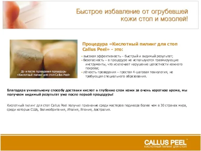 Процедура «Кислотный пилинг для стоп Callus Peel» - это: высокая эффективность –