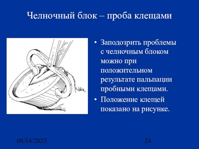 08/14/2023 Челночный блок – проба клещами Заподозрить проблемы с челночным блоком можно