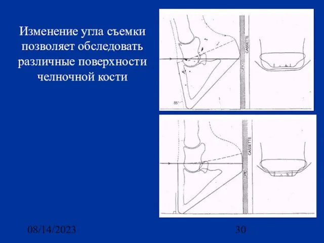 08/14/2023 Изменение угла съемки позволяет обследовать различные поверхности челночной кости