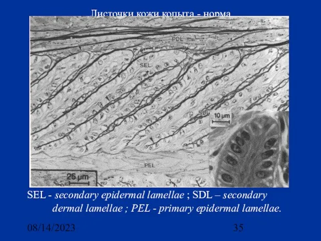 08/14/2023 Листочки кожи копыта - норма SEL - secondary epidermal lamellae ;