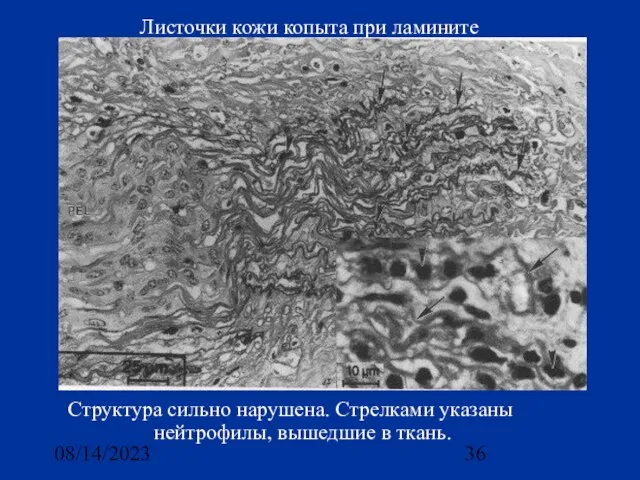 08/14/2023 Листочки кожи копыта при ламините Структура сильно нарушена. Стрелками указаны нейтрофилы, вышедшие в ткань.