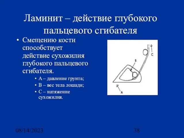 08/14/2023 Ламинит – действие глубокого пальцевого сгибателя Смещению кости способствует действие сухожилия