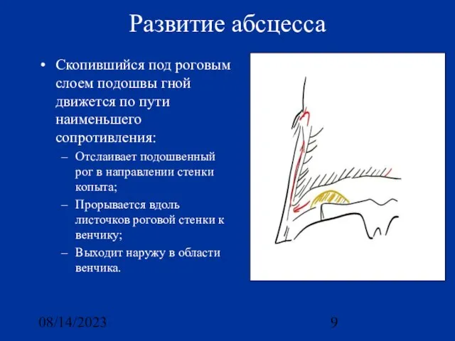 08/14/2023 Развитие абсцесса Скопившийся под роговым слоем подошвы гной движется по пути