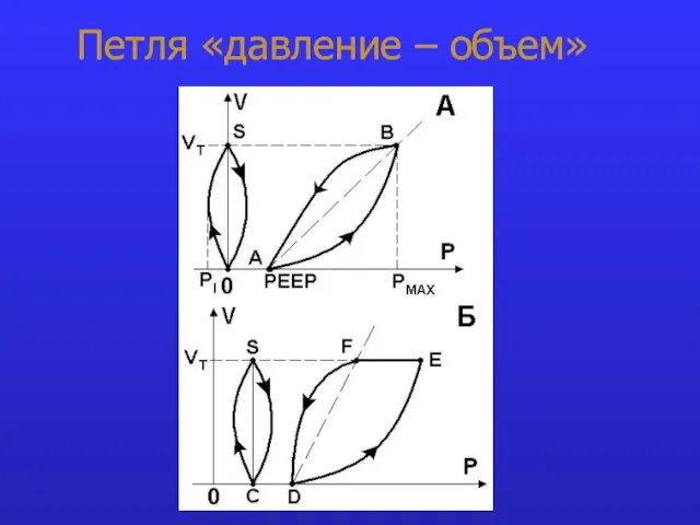 Петля «давление – объем»