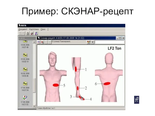 Пример: СКЭНАР-рецепт