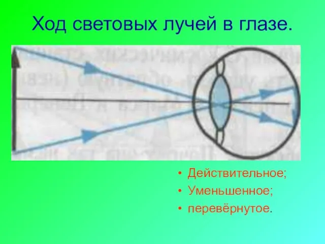 Ход световых лучей в глазе. Действительное; Уменьшенное; перевёрнутое.