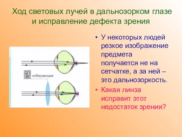 Ход световых лучей в дальнозорком глазе и исправление дефекта зрения У некоторых