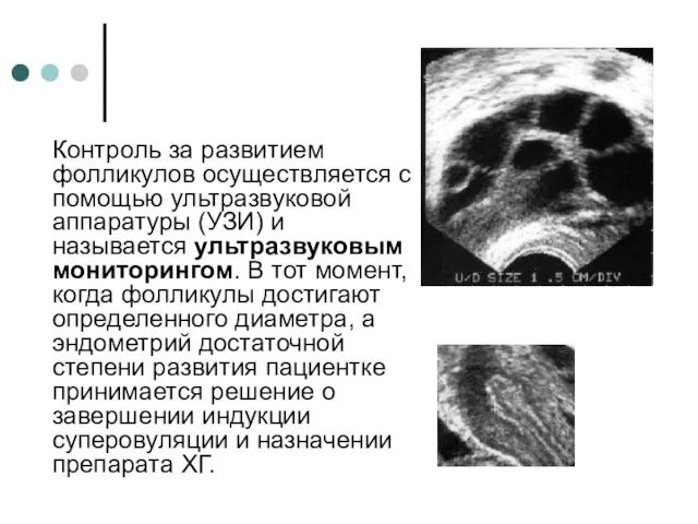 Контроль за развитием фолликулов осуществляется с помощью ультразвуковой аппаратуры (УЗИ) и называется