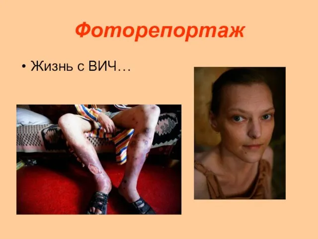 Фоторепортаж Жизнь с ВИЧ…