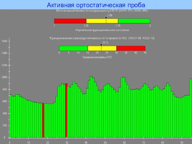 Активная ортостатическая проба