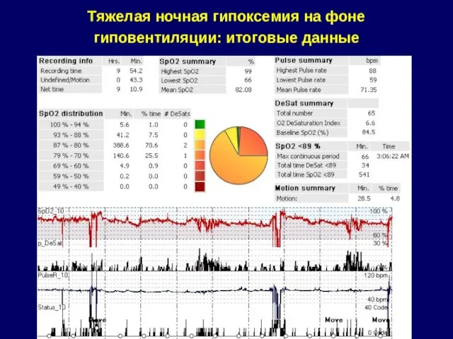 Тяжелая ночная гипоксемия на фоне гиповентиляции: итоговые данные