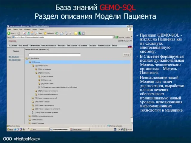 База знаний GEMO-SQL Раздел описания Модели Пациента - Принцип GEMO-SQL - взгляд